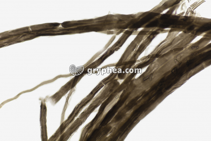 Noeuds de Ranvier Nerf AO dissociation x100 - gryphea.com